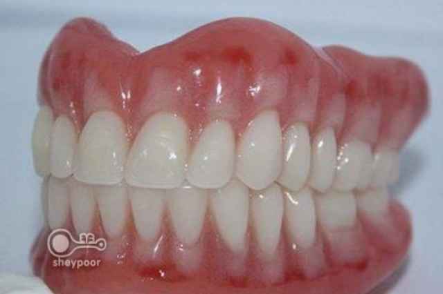 دندان مصنوعي ارزان