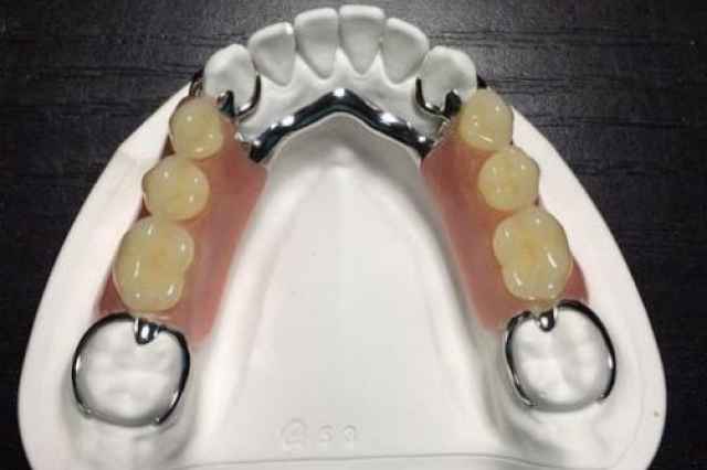 دندان مصنوعي رايگان