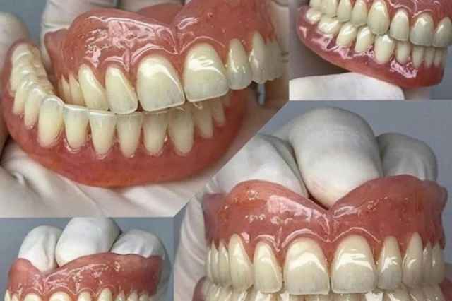 لابراتوار دندانسازي ساخت دندان مصنوعي ژله اي