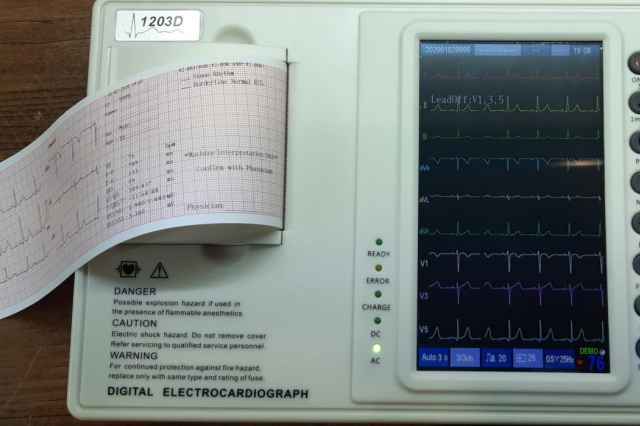 تعميرات دستگاه نوار قلب ECG