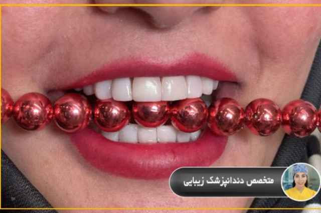 متخصص دندانپزشك زيبايي در تهران